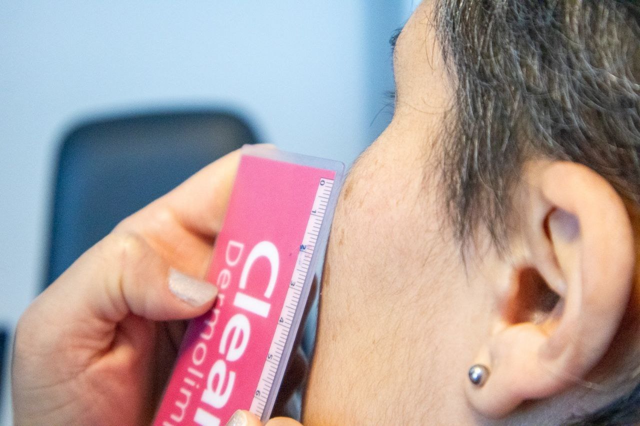 Río Grande abre las inscripciones para una nueva campaña de detección Precoz de cáncer de piel